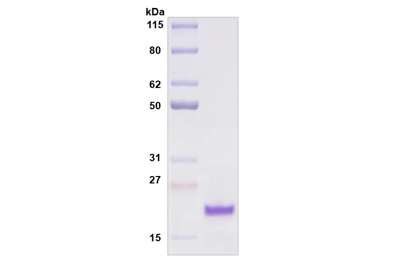 [MC11-100] Recombinant Human Siglec-8, His Tag -100 ug